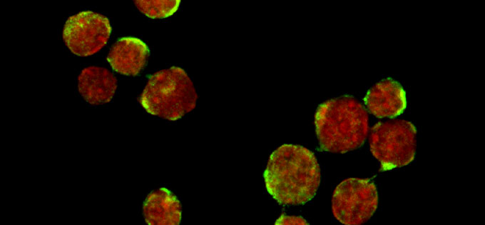 A new method to grow stem cells for cancer patients