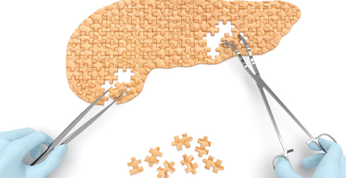 OICR-led study finds four unique genomic signatures in pancreas cancer, uncovers potential of immunotherapies