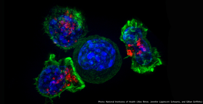 Superresolution image of a group of killer T cells (green and red) surrounding a cancer cell (blue, center). When a killer T cell makes contact with a target cell, the killer cell attaches and spreads over the dangerous target. The killer cell then uses special chemicals housed in vesicles (red) to deliver the killing blow.