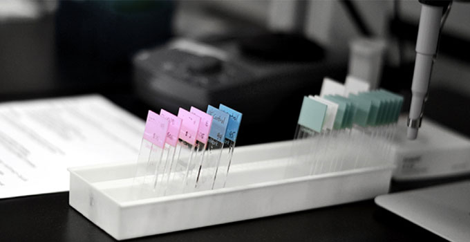 Pathology slides sit in a tray on a lab bench top.