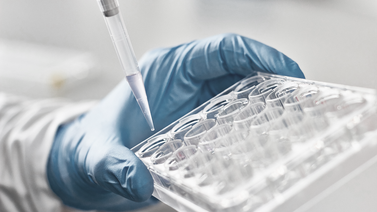 New gene signature test predicts risk of acute myeloid leukemia relapse