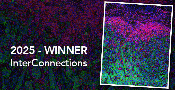 Winner of InterConnections competition